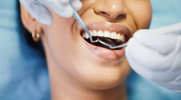 Best Emergency Treatment for Dental Infections or Abscesses in Evanston, WY